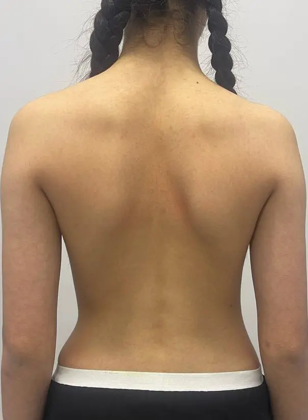 После лечения