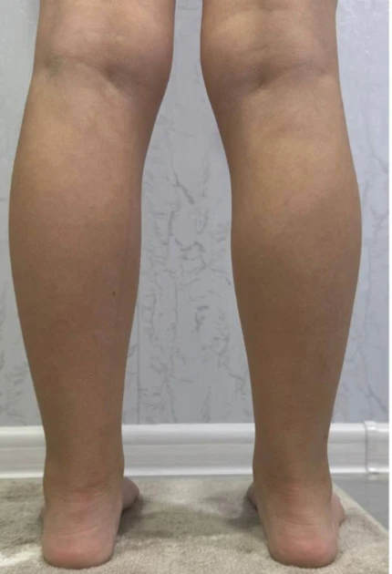 После лечения